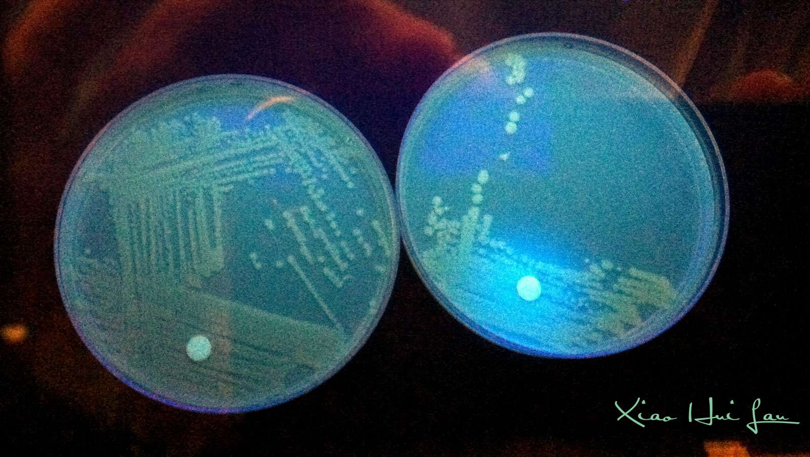 MUG (beta-Glucuronidase) test for the detection of Escherichia coli