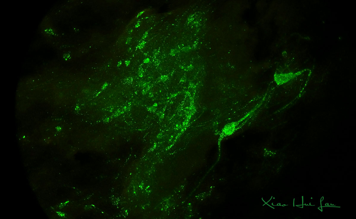 Positive brain tissue by Rabies Direct Fluorescent Antibody (DFA) test